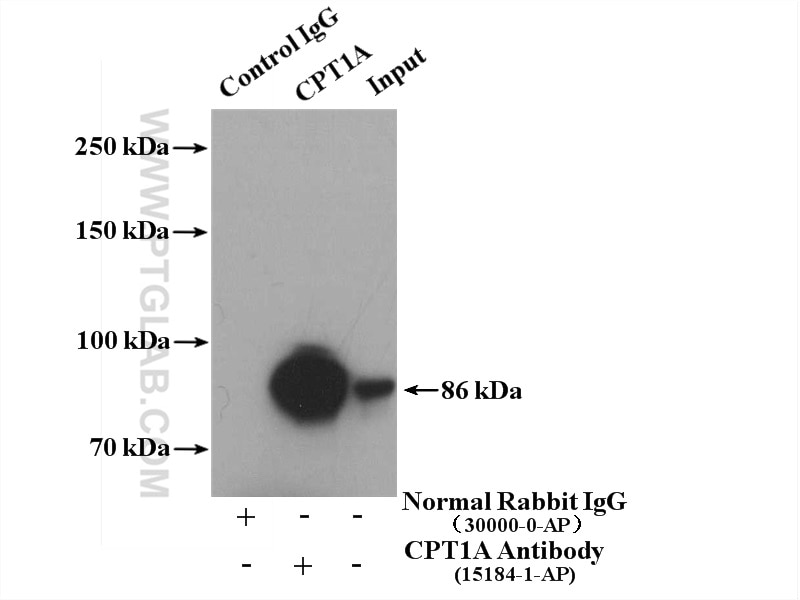 IP experiment of HepG2 using 15184-1-AP