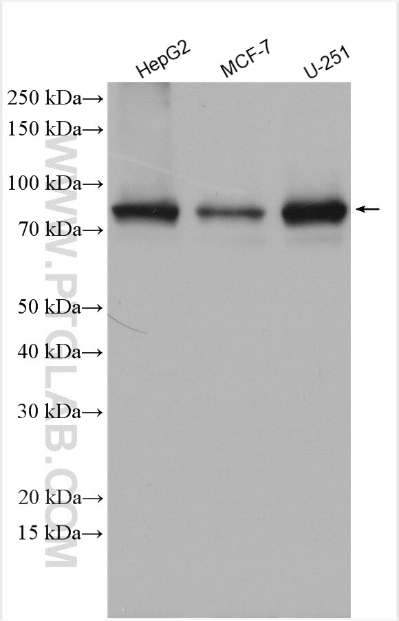 Western Blot (WB) analysis of various lysates using CPT1A Polyclonal antibody (15184-1-AP)