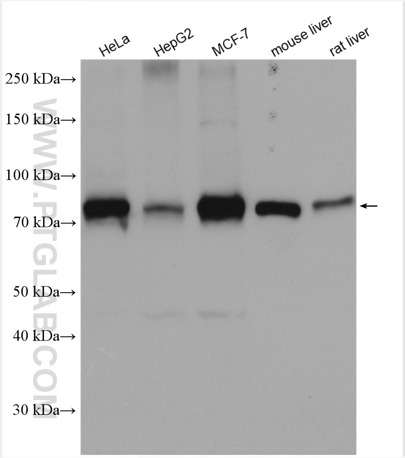 Western Blot (WB) analysis of various lysates using CPT1A Polyclonal antibody (15184-1-AP)