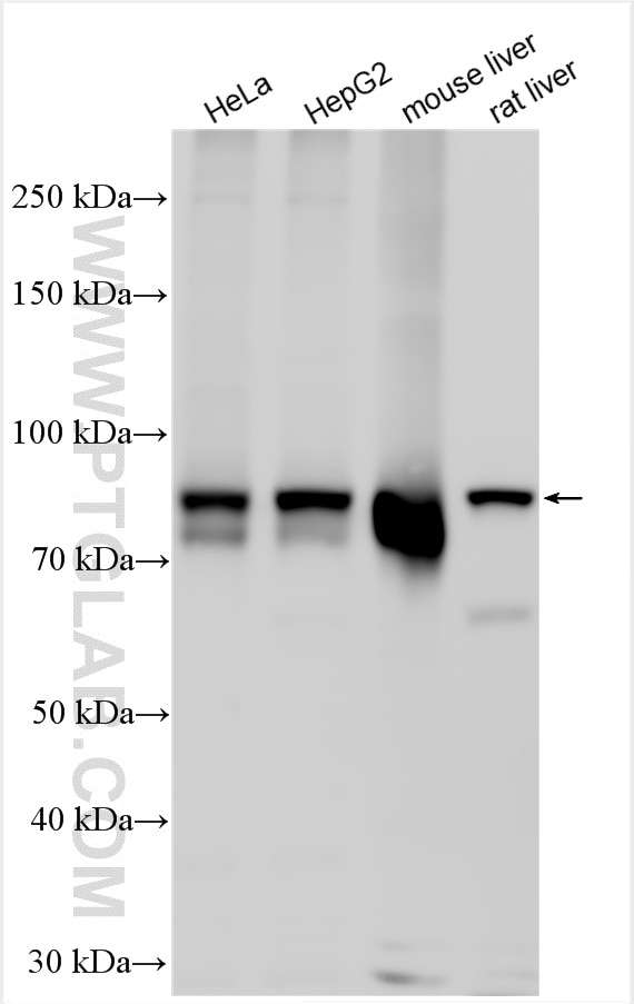 Western Blot (WB) analysis of various lysates using CPT1A Polyclonal antibody (15184-1-AP)