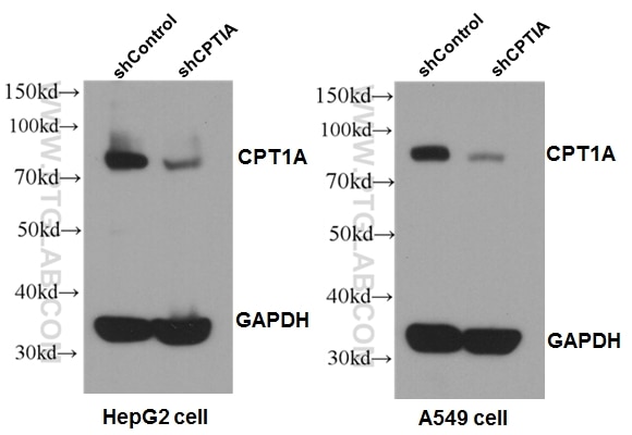 Western Blot (WB) analysis of A549 cells using CPT1A Polyclonal antibody (15184-1-AP)