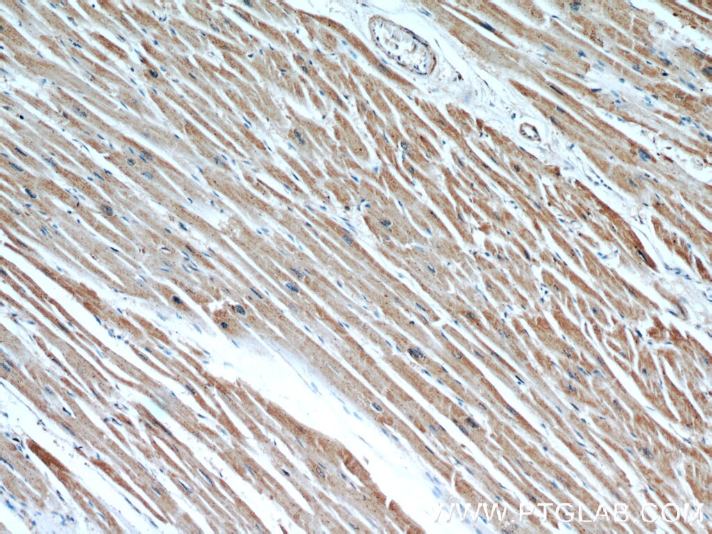 CPT1A Monoclonal antibody