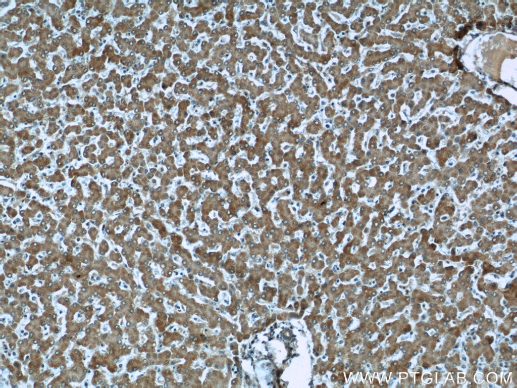 Immunohistochemistry (IHC) staining of human liver tissue using CPT1A Monoclonal antibody (66039-1-Ig)