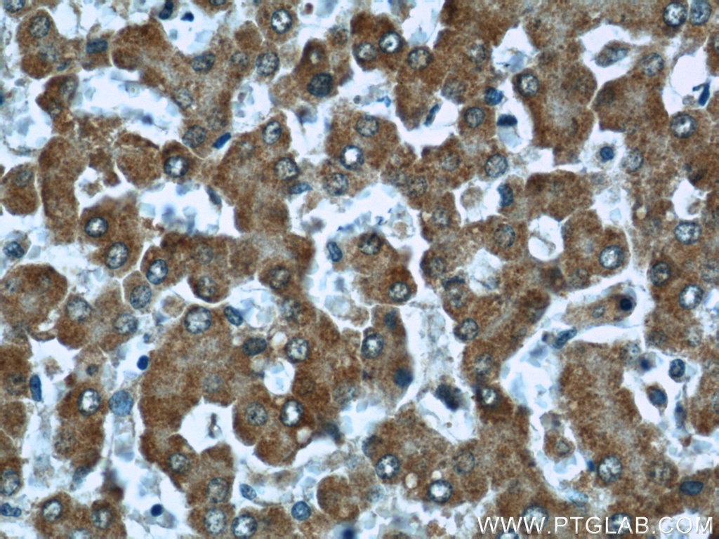 Immunohistochemistry (IHC) staining of human liver tissue using CPT1A Monoclonal antibody (66039-1-Ig)