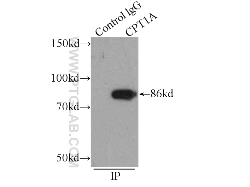 Immunoprecipitation (IP) experiment of MCF-7 cells using CPT1A Monoclonal antibody (66039-1-Ig)