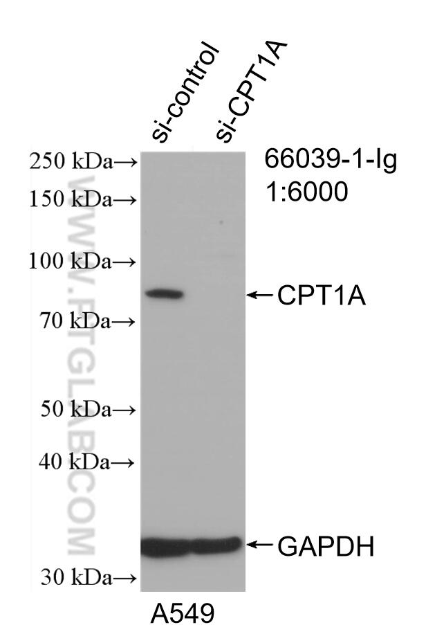 Western Blot (WB) analysis of A549 cells using CPT1A Monoclonal antibody (66039-1-Ig)