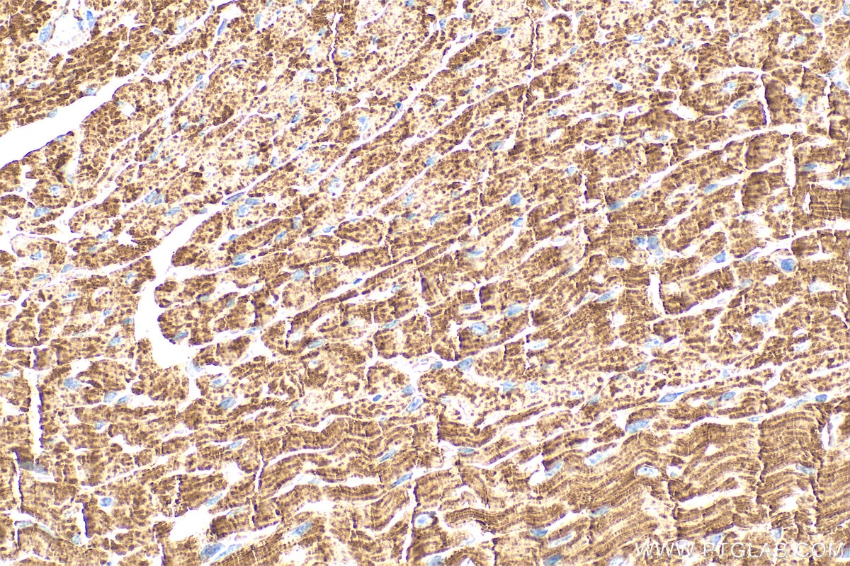 Immunohistochemistry (IHC) staining of mouse heart tissue using CPT1A Monoclonal antibody (66039-3-Ig)
