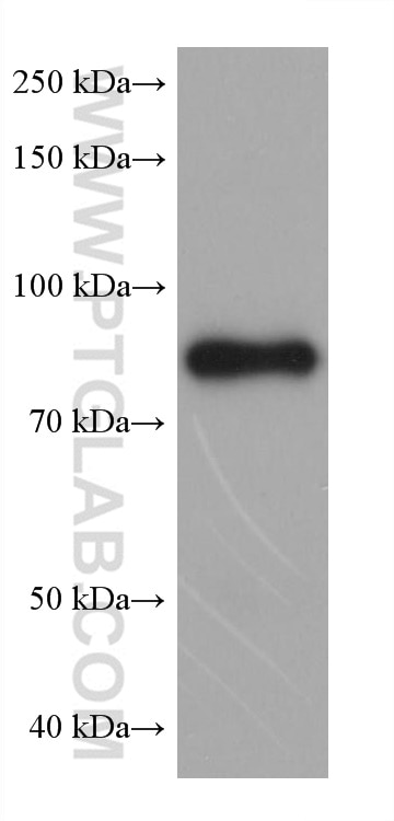 Western Blot (WB) analysis of mouse liver tissue using CPT1A Monoclonal antibody (66039-3-Ig)