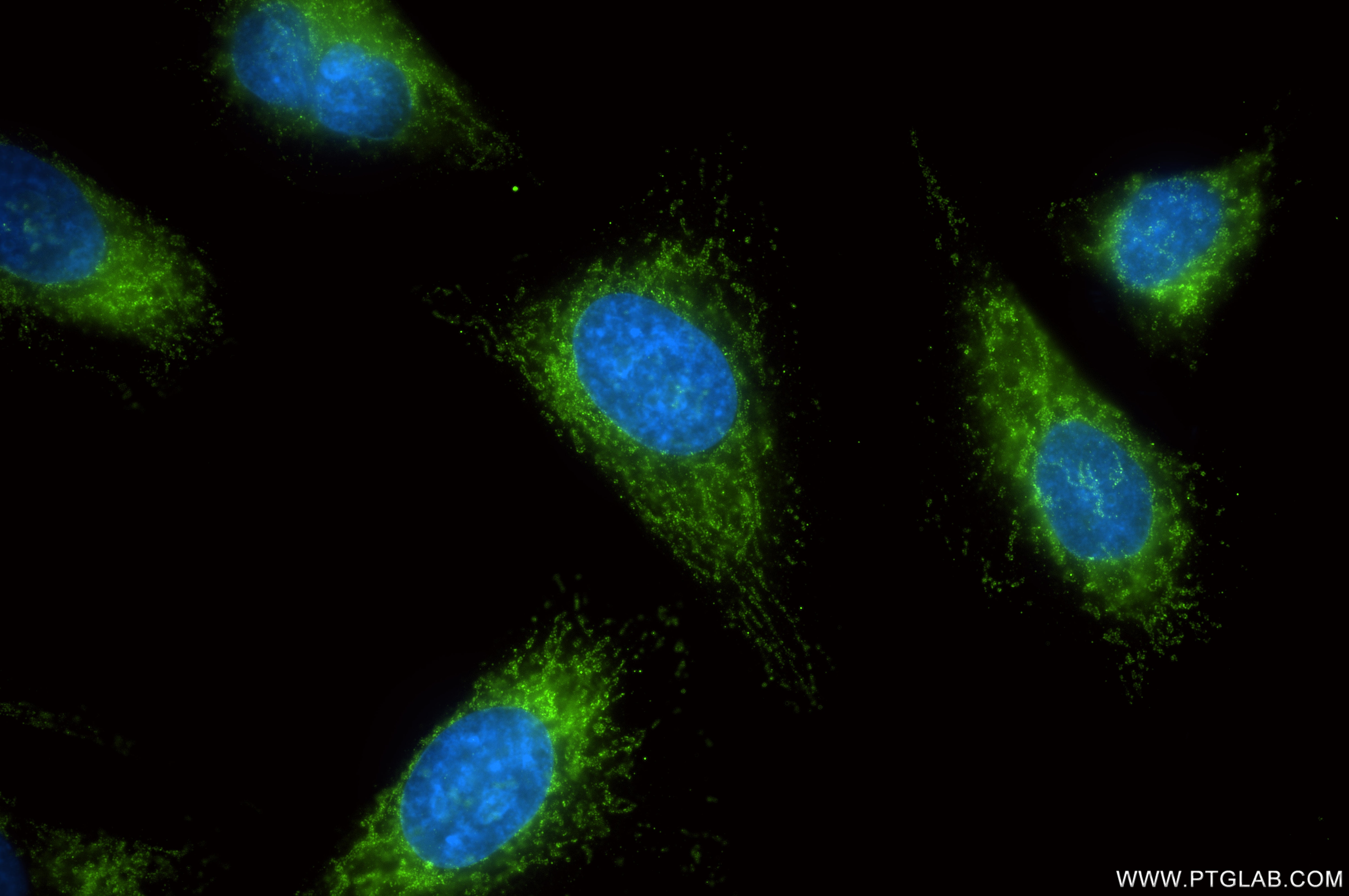 Immunofluorescence (IF) / fluorescent staining of HeLa cells using CPT1A Recombinant monoclonal antibody (82012-2-RR)