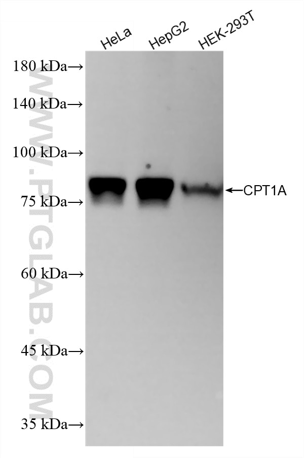 Western Blot (WB) analysis of various lysates using CPT1A Recombinant monoclonal antibody (82012-2-RR)