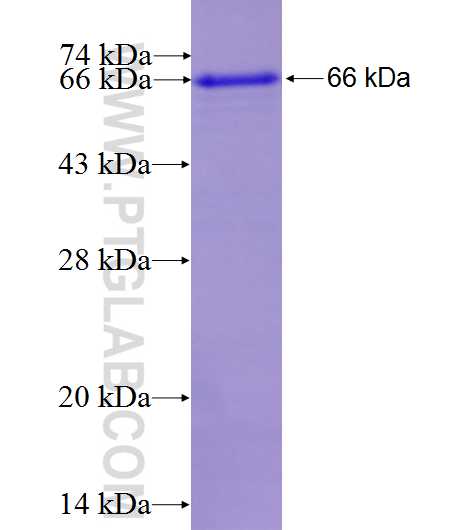 CPT1A fusion protein Ag7202 SDS-PAGE