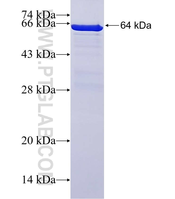 CPT1A fusion protein Ag7202 SDS-PAGE