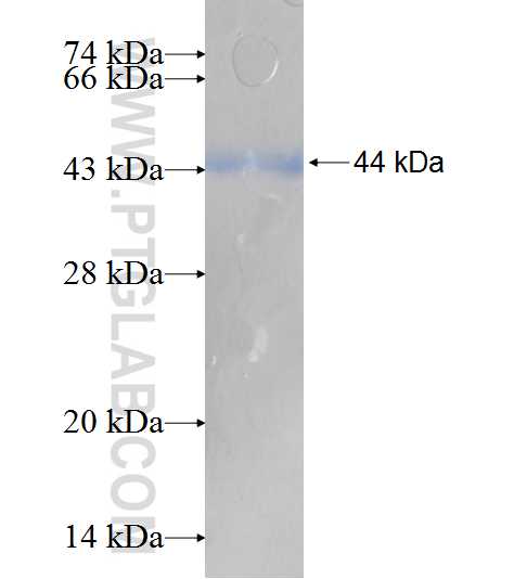 CPT1A fusion protein Ag7745 SDS-PAGE