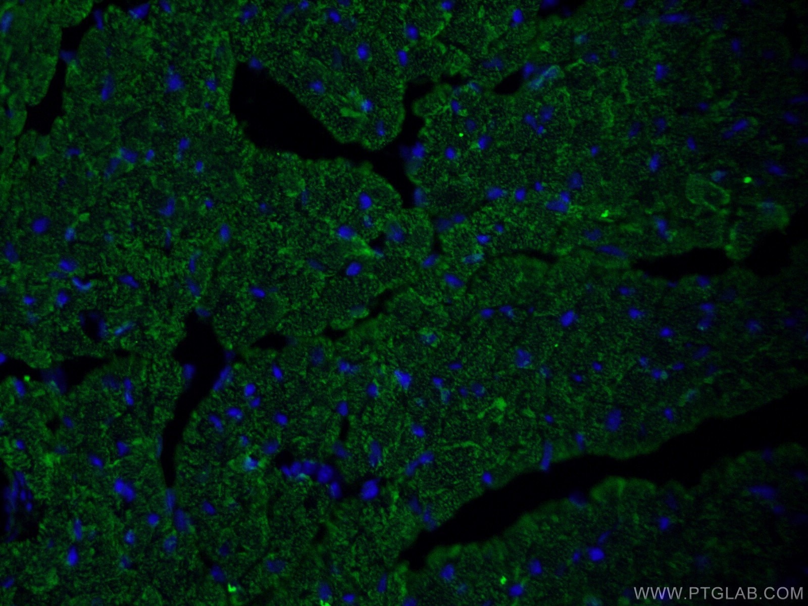 IF Staining of mouse heart using 22170-1-AP