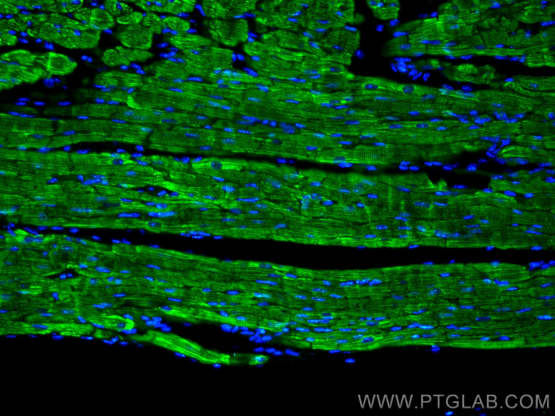 IF Staining of mouse heart using 22170-1-AP