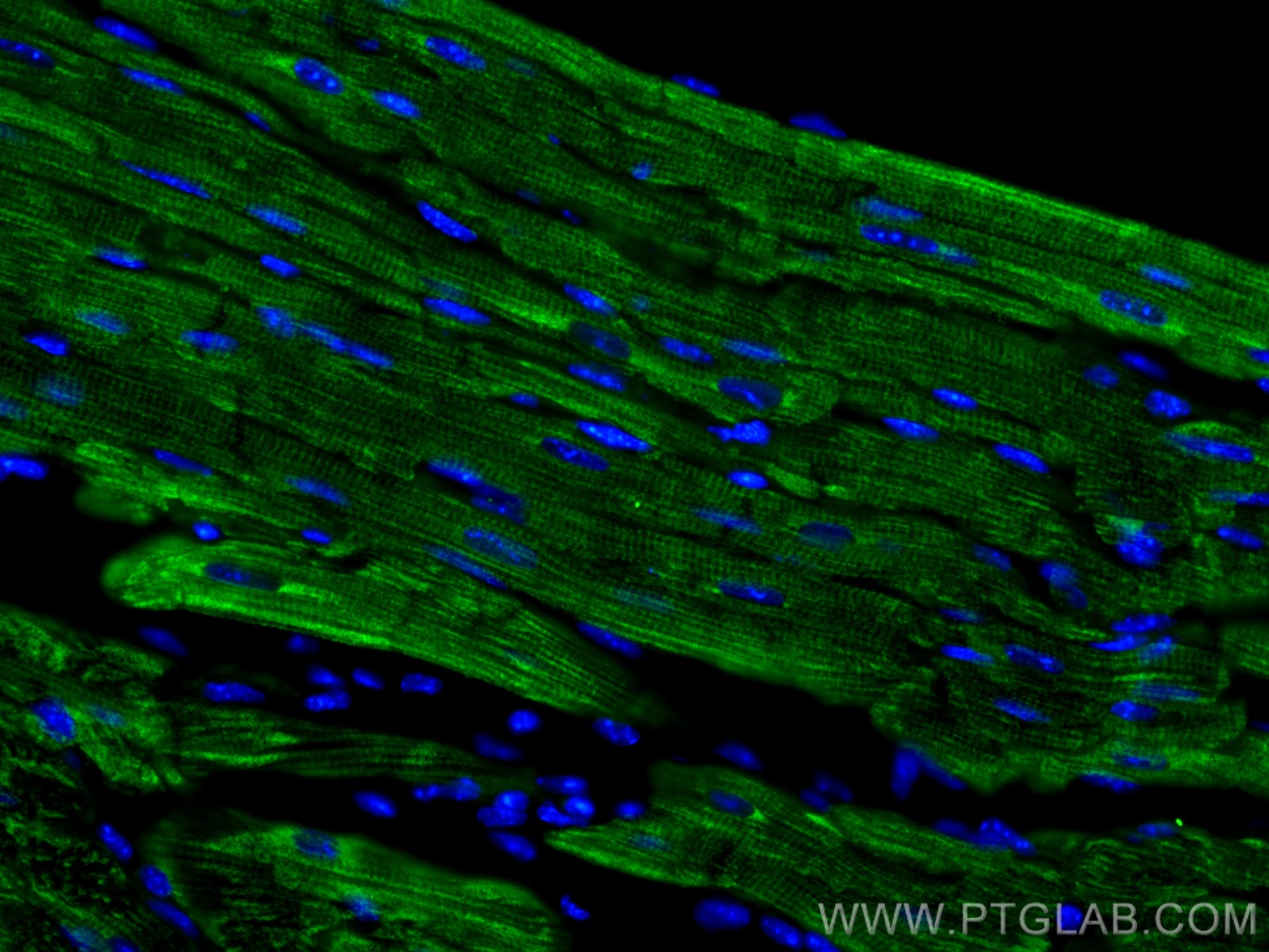 IF Staining of mouse heart using 22170-1-AP