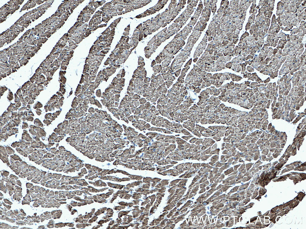 Immunohistochemistry (IHC) staining of mouse heart tissue using CPT1B-specific Polyclonal antibody (22170-1-AP)