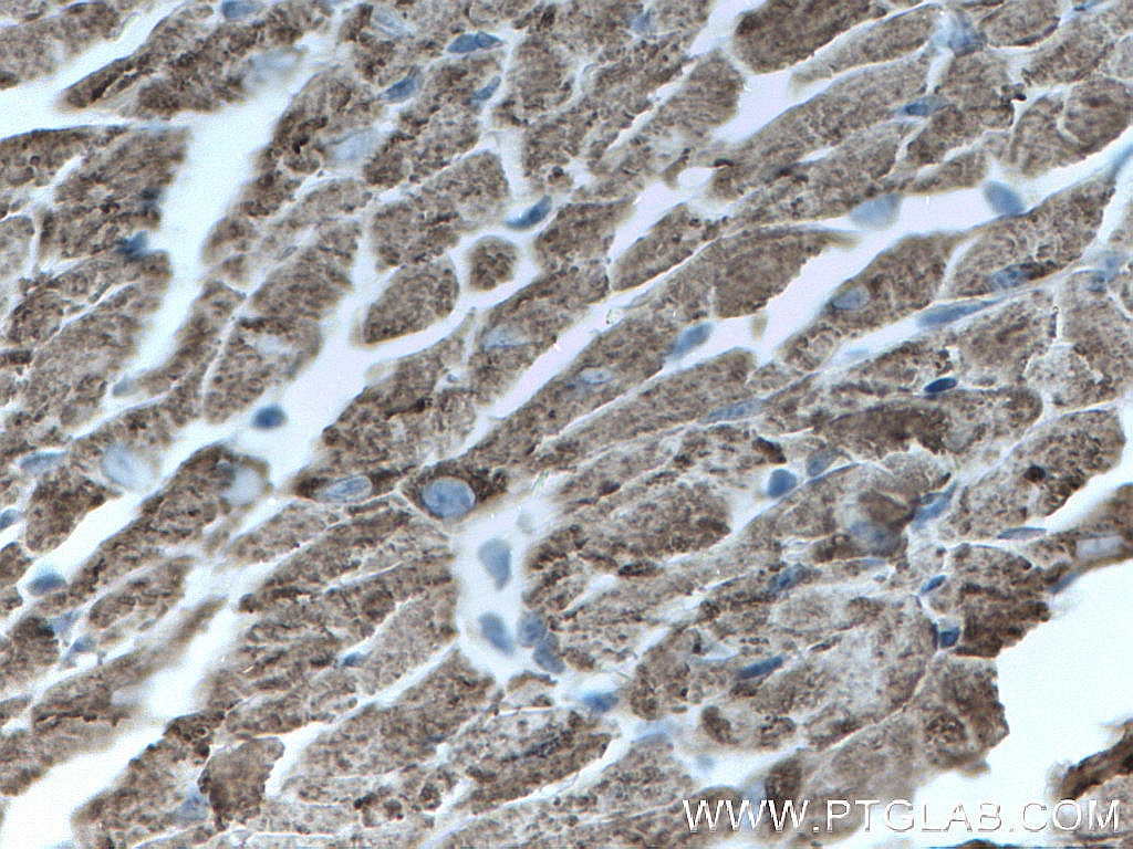 Immunohistochemistry (IHC) staining of mouse heart tissue using CPT1B-specific Polyclonal antibody (22170-1-AP)