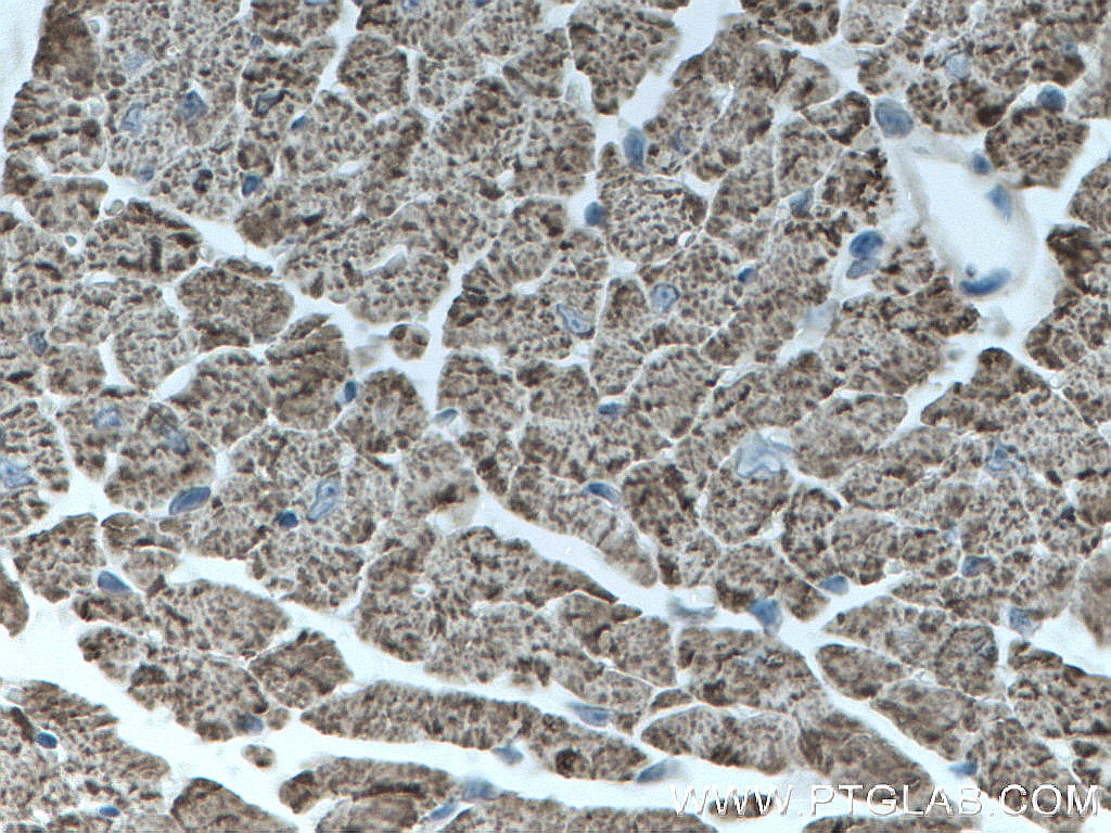 Immunohistochemistry (IHC) staining of mouse heart tissue using CPT1B-specific Polyclonal antibody (22170-1-AP)