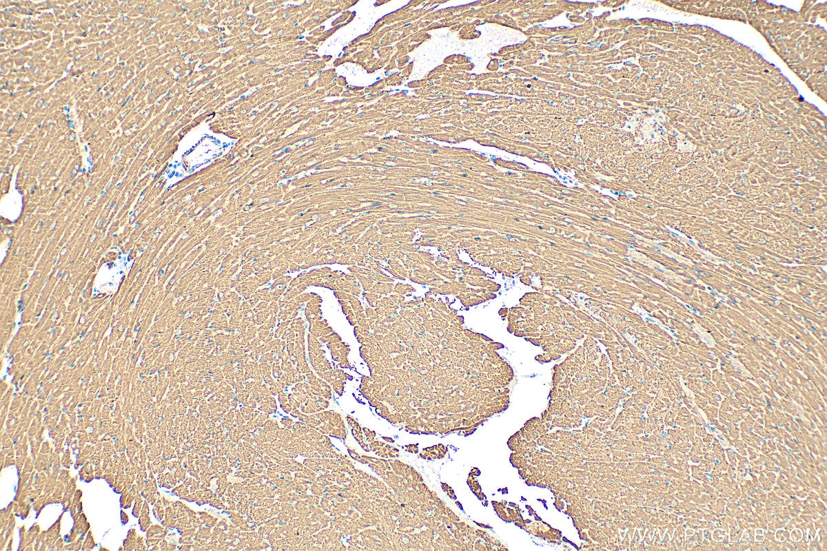 Immunohistochemistry (IHC) staining of mouse heart tissue using CPT1B-specific Polyclonal antibody (22170-1-AP)