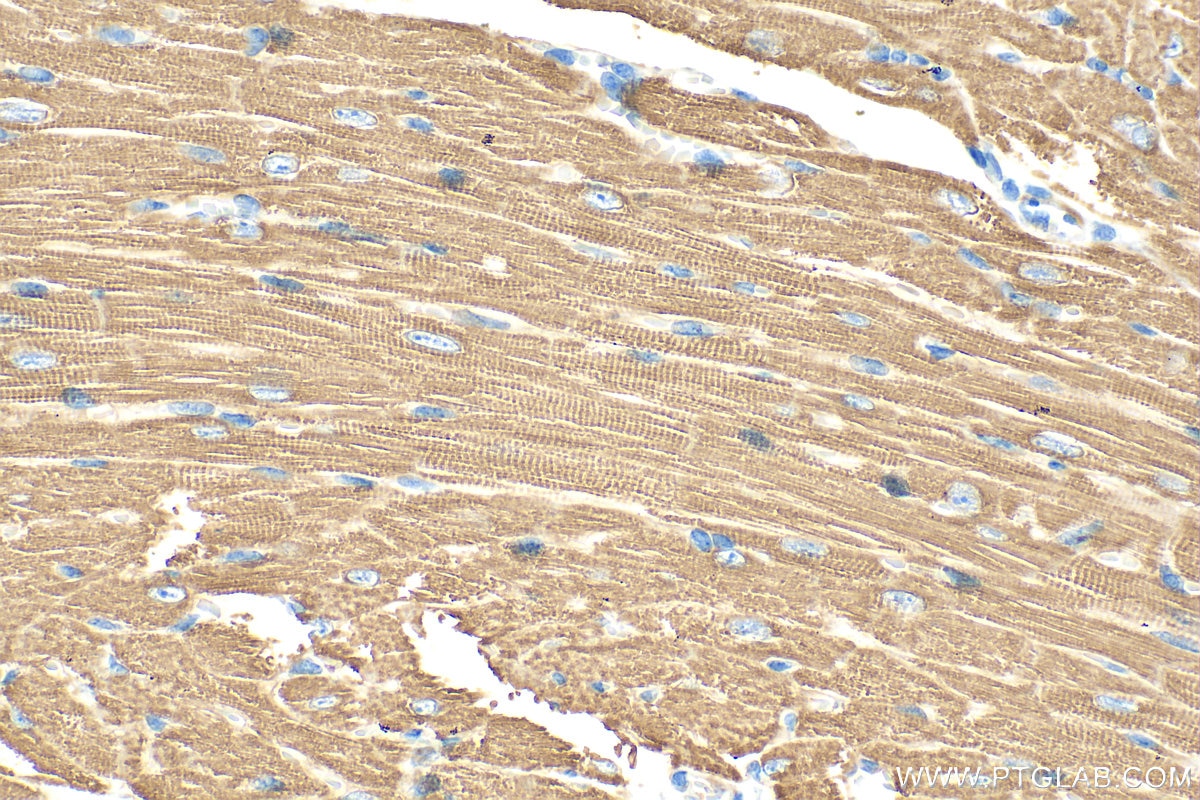 Immunohistochemistry (IHC) staining of mouse heart tissue using CPT1B-specific Polyclonal antibody (22170-1-AP)