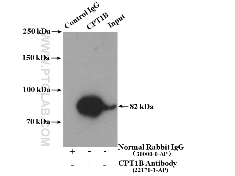 Immunoprecipitation (IP) experiment of mouse heart tissue using CPT1B-specific Polyclonal antibody (22170-1-AP)