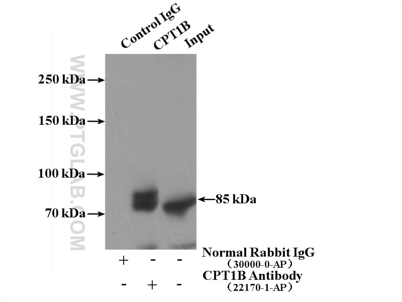 Immunoprecipitation (IP) experiment of mouse skeletal muscle tissue using CPT1B-specific Polyclonal antibody (22170-1-AP)
