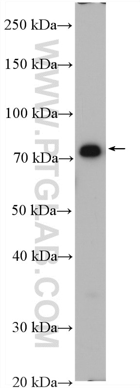 Western Blot (WB) analysis of mouse skeletal muscle tissue using CPT1B-specific Polyclonal antibody (22170-1-AP)