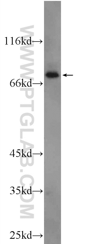 Western Blot (WB) analysis of mouse heart tissue using CPT1B-specific Polyclonal antibody (22170-1-AP)