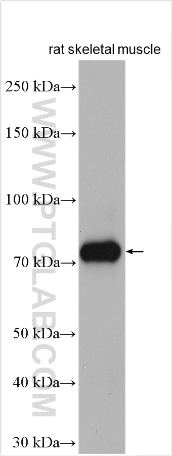 Western Blot (WB) analysis of rat skeletal muscle tissue using CPT1B-specific Polyclonal antibody (22170-1-AP)