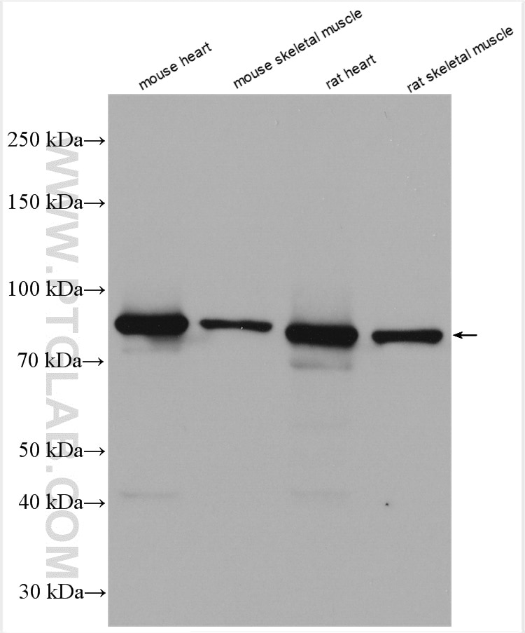Western Blot (WB) analysis of various lysates using CPT1B-specific Polyclonal antibody (22170-1-AP)