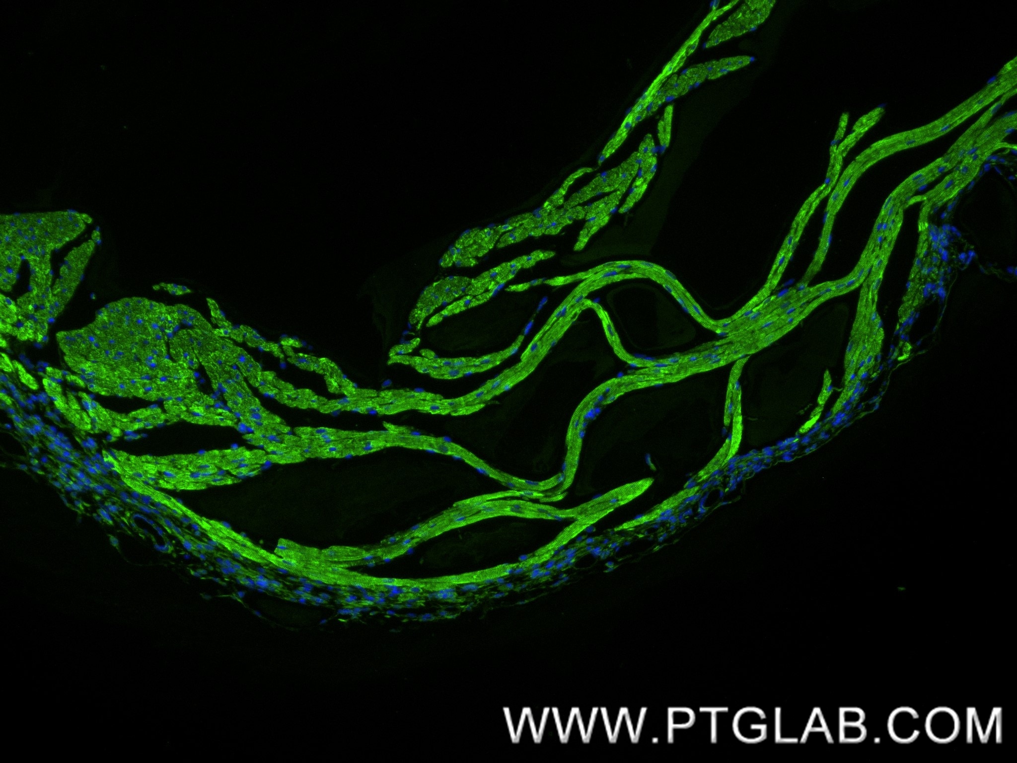 Immunofluorescence (IF) / fluorescent staining of mouse heart tissue using CPT1B Recombinant antibody (82701-3-RR)