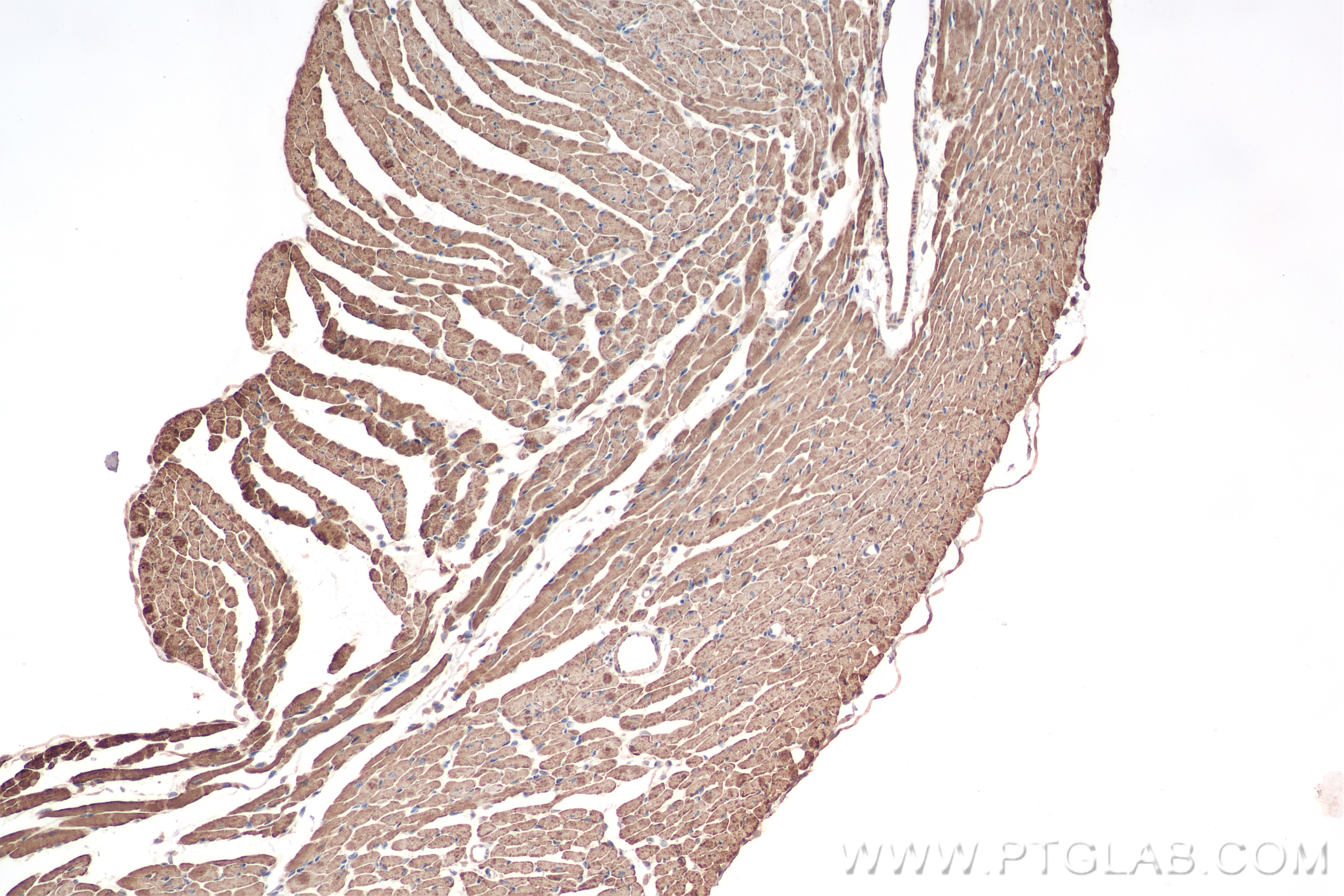 Immunohistochemistry (IHC) staining of mouse heart tissue using CPT1B Recombinant antibody (82701-3-RR)