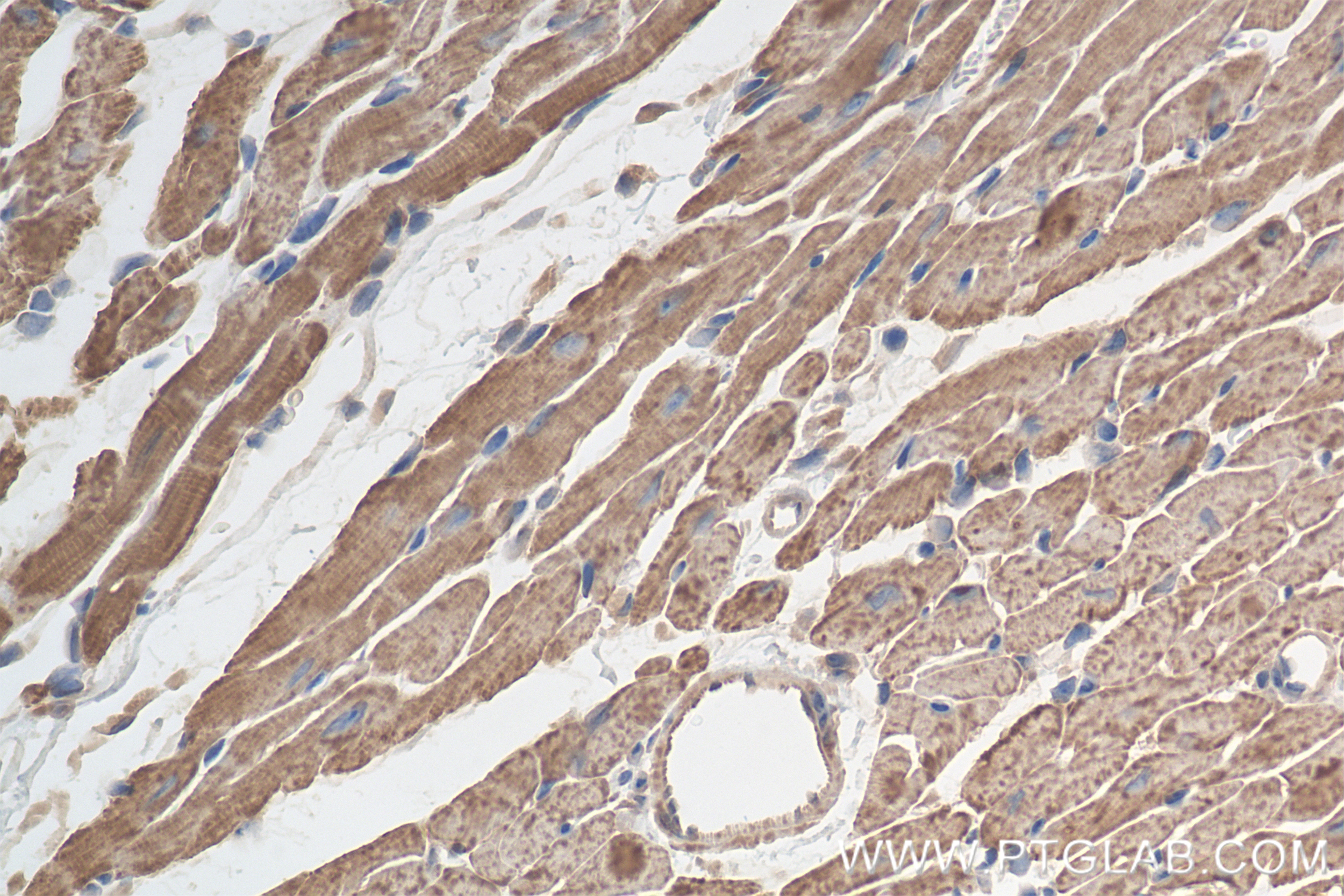 Immunohistochemistry (IHC) staining of mouse heart tissue using CPT1B Recombinant antibody (82701-3-RR)