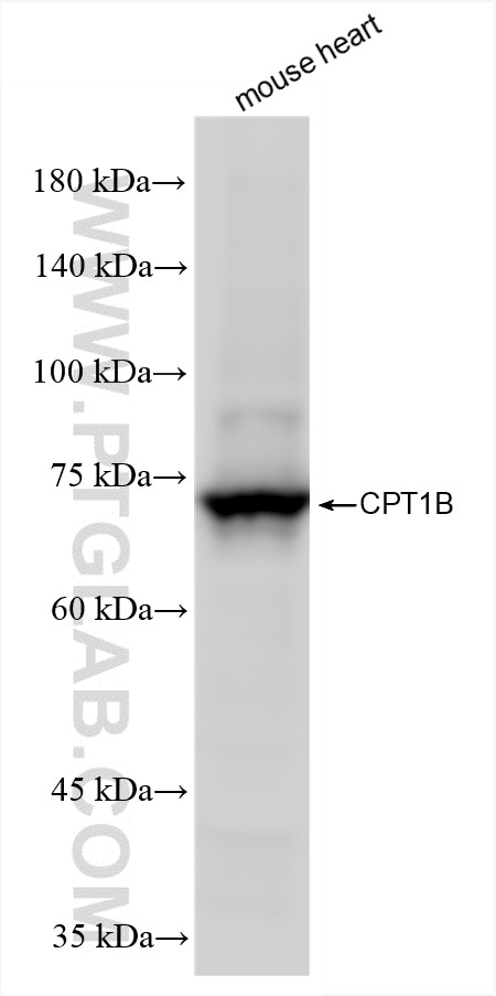 Western Blot (WB) analysis of mouse heart tissue using CPT1B Recombinant antibody (82701-3-RR)