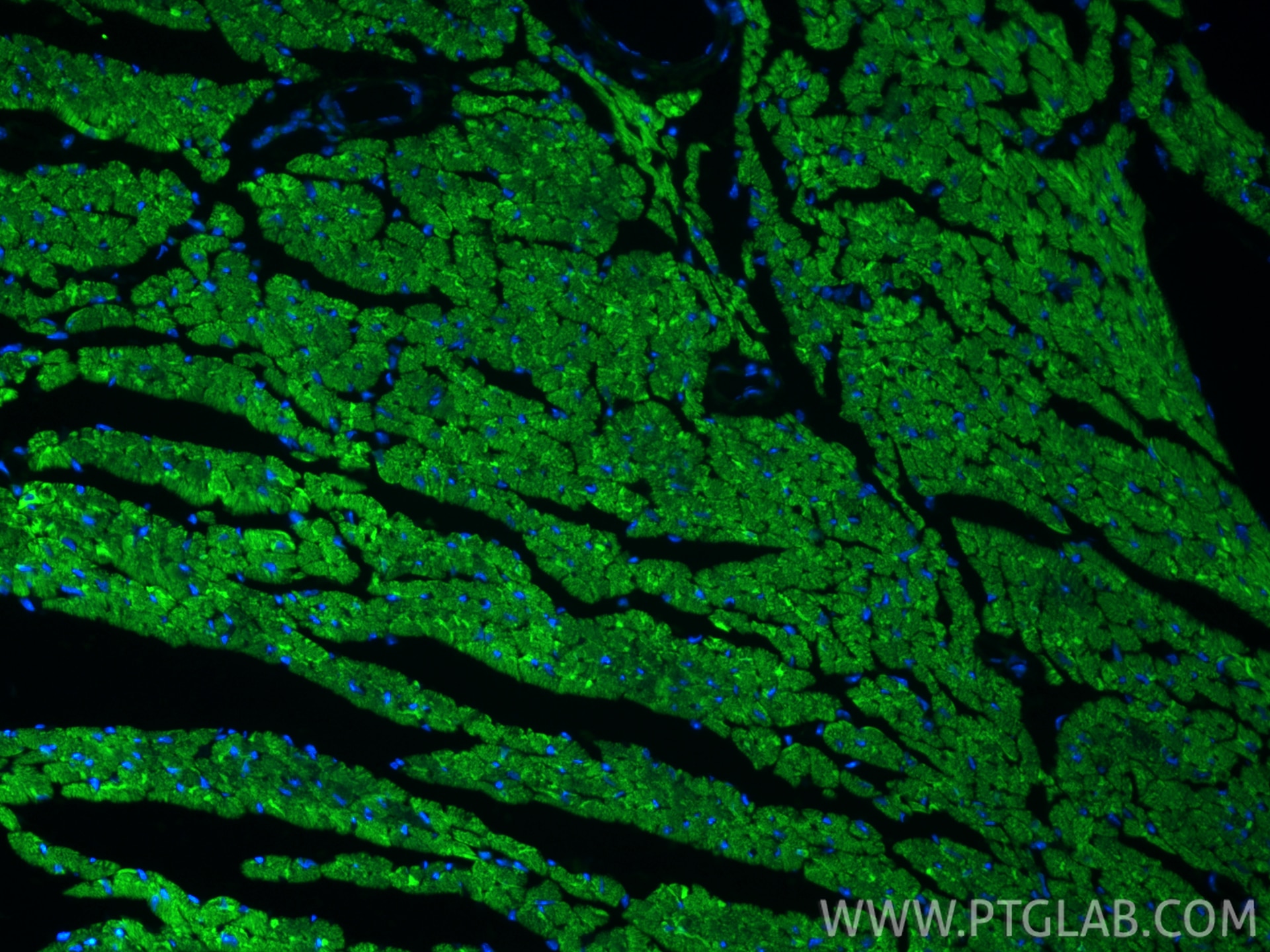 IF Staining of mouse heart using CL488-82701-3 Immunofluorescence (IF) / fluorescent staining of mouse heart tissue using CoraLite® Plus 488-conjugated CPT1B Recombinant mo (CL488-82701-3)