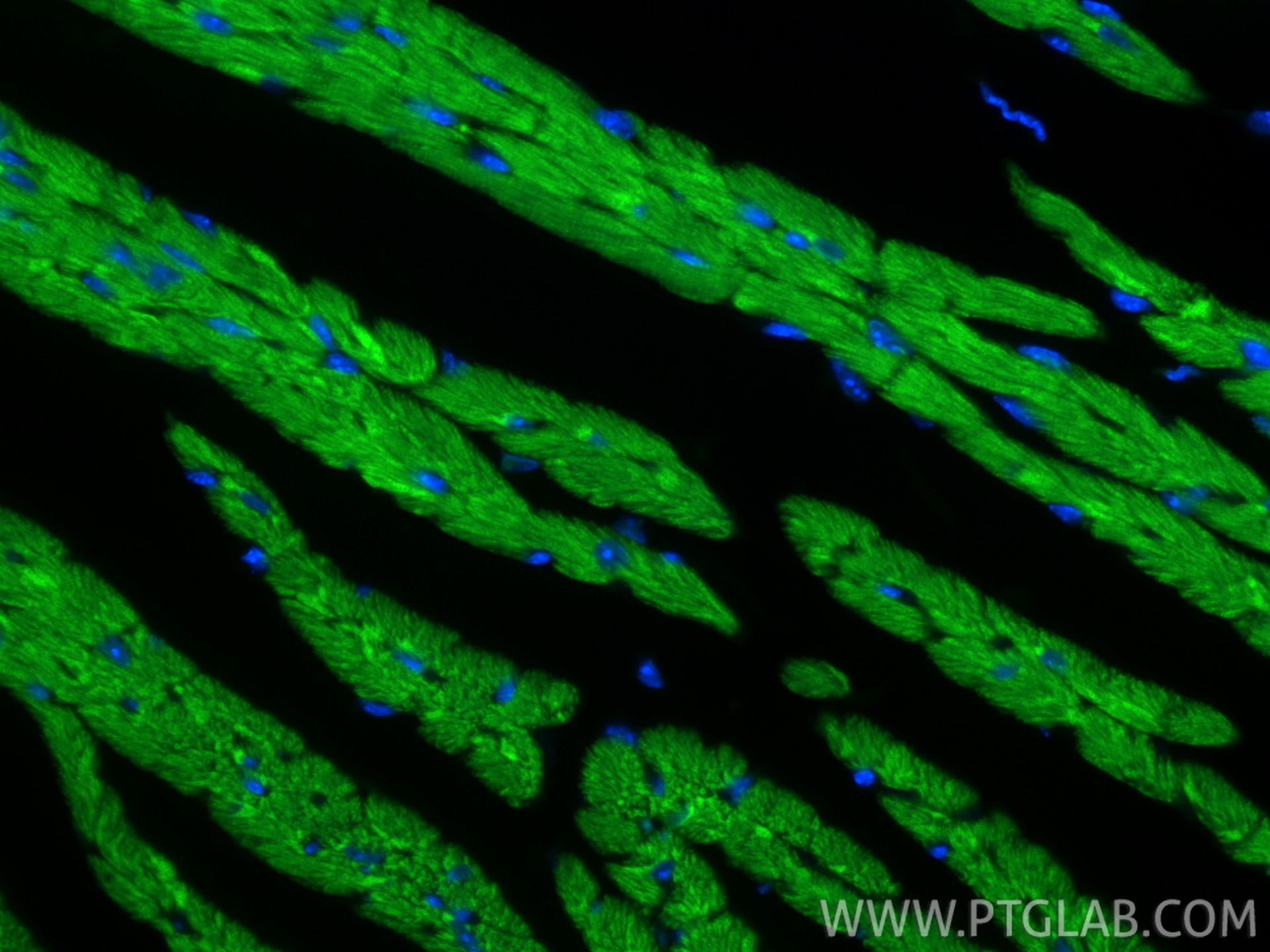 IF Staining of mouse heart using CL488-82701-3 Immunofluorescence (IF) / fluorescent staining of mouse heart tissue using CoraLite® Plus 488-conjugated CPT1B Recombinant mo (CL488-82701-3)