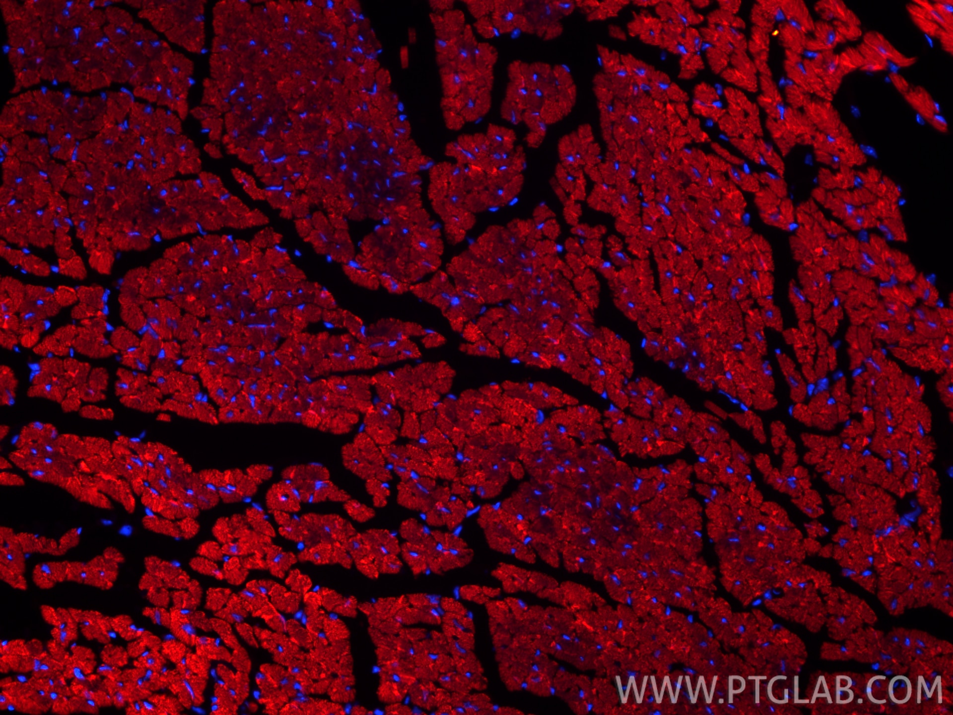 IF Staining of mouse heart using CL594-82701-3 Immunofluorescence (IF) / fluorescent staining of mouse heart tissue using CoraLite®594-conjugated CPT1B Recombinant monoclon (CL594-82701-3)