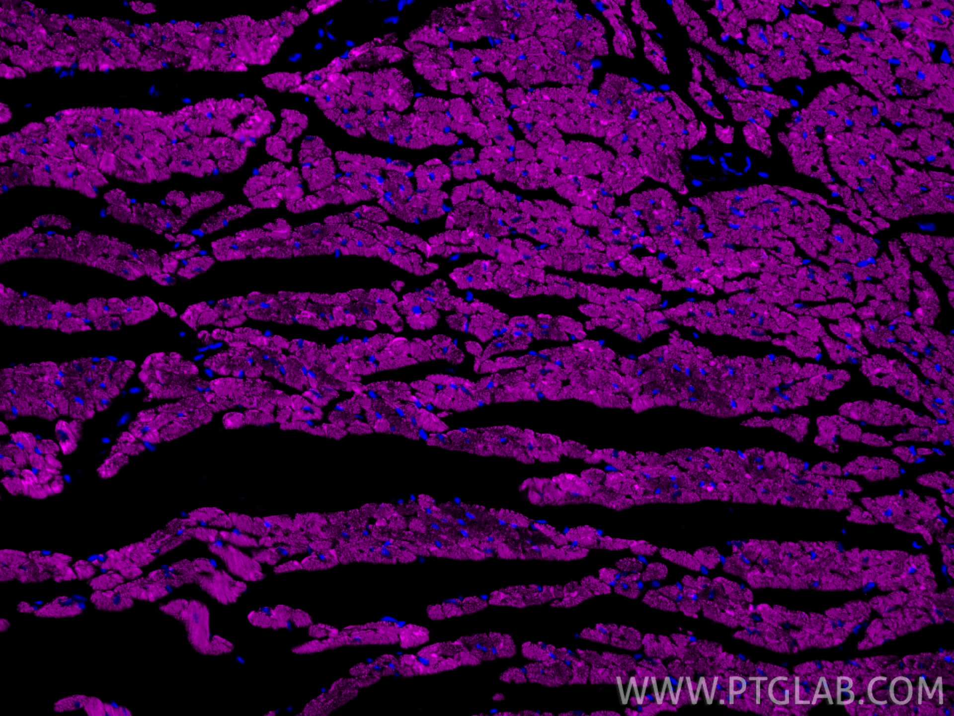 IF Staining of mouse heart using CL647-82701-3 Immunofluorescence (IF) / fluorescent staining of mouse heart tissue using CoraLite® Plus 647-conjugated CPT1B Recombinant mo (CL647-82701-3)