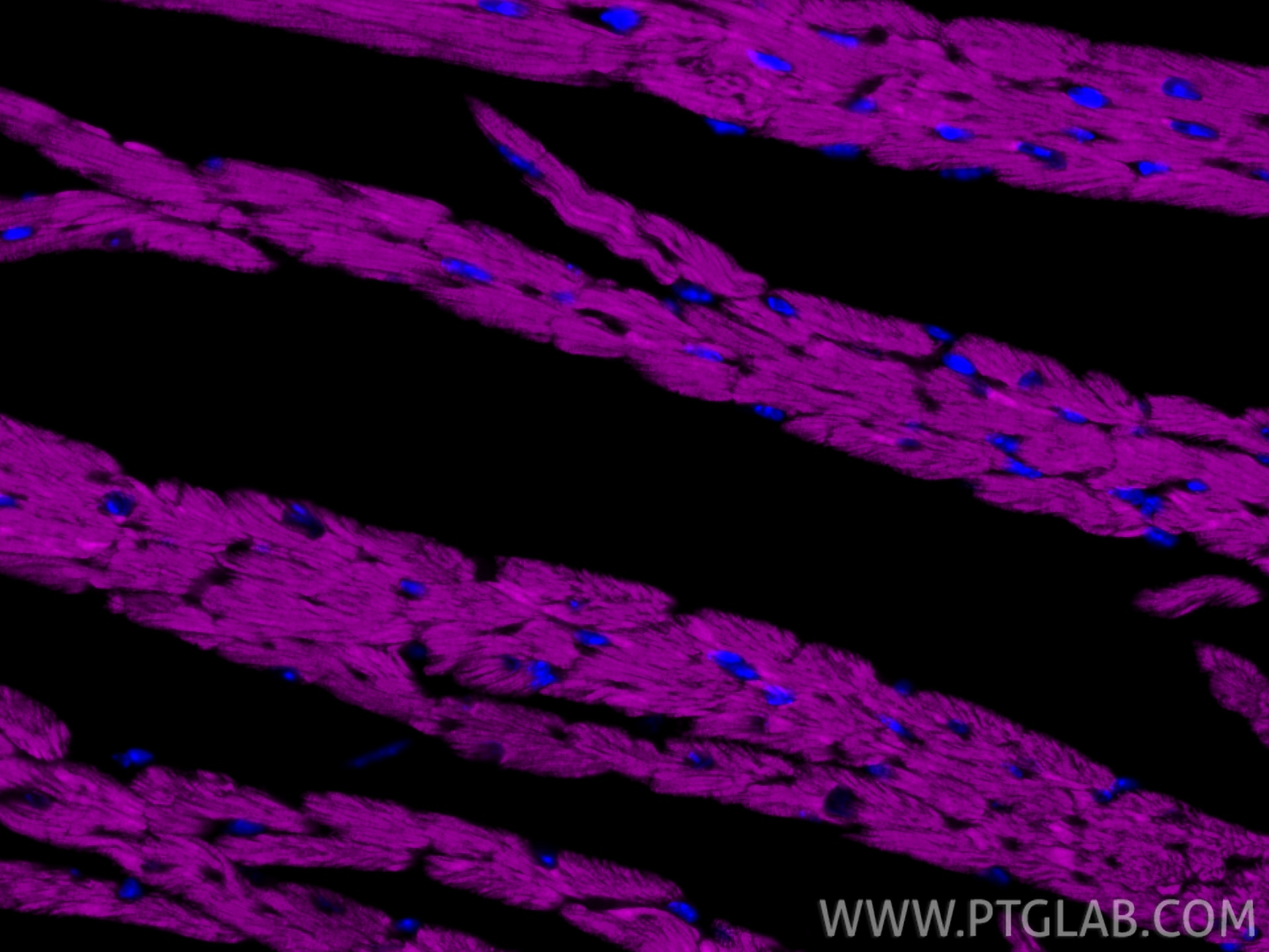 IF Staining of mouse heart using CL647-82701-3 Immunofluorescence (IF) / fluorescent staining of mouse heart tissue using CoraLite® Plus 647-conjugated CPT1B Recombinant mo (CL647-82701-3)