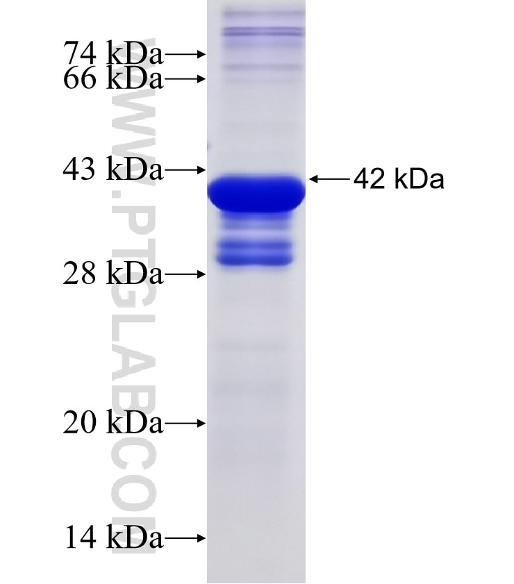 CPT1B fusion protein Ag17840 SDS-PAGE
