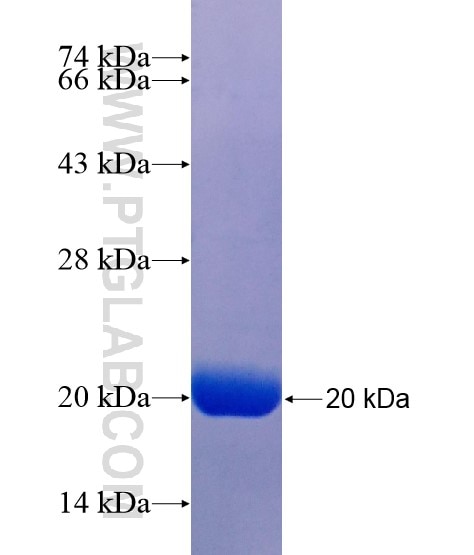 CPT1B fusion protein Ag19056 SDS-PAGE
