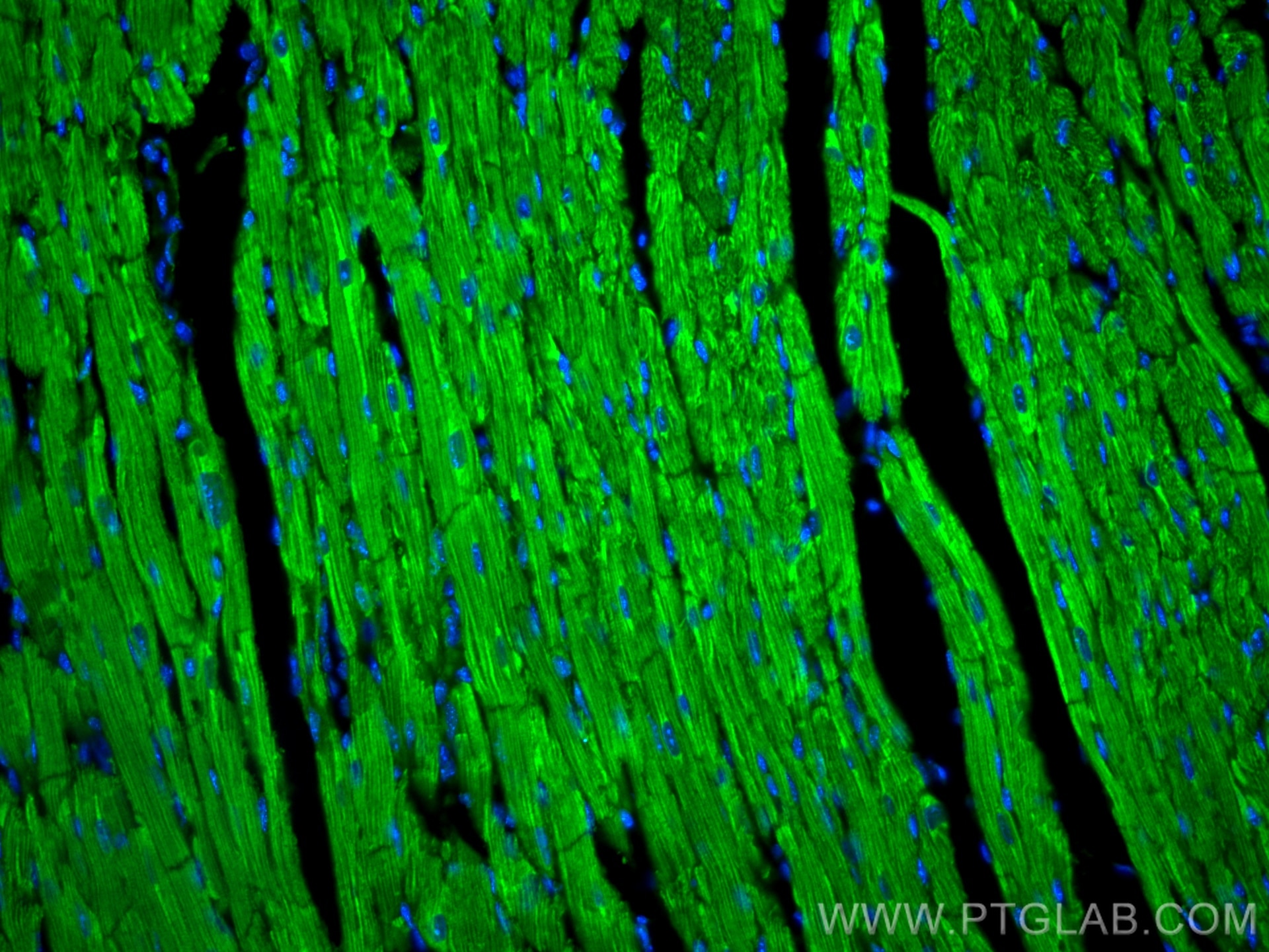 Immunofluorescence (IF) / fluorescent staining of mouse heart tissue using CoraLite® Plus 488-conjugated CPT1B-specific Polyc (CL488-22170)