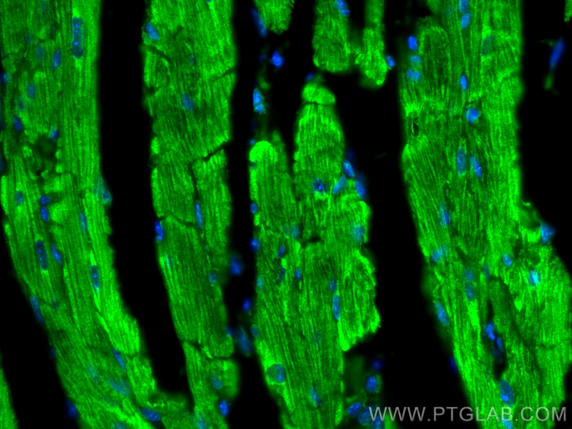 Immunofluorescence (IF) / fluorescent staining of mouse heart tissue using CoraLite® Plus 488-conjugated CPT1B-specific Polyc (CL488-22170)