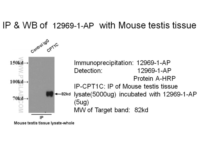 CPT1C-specific