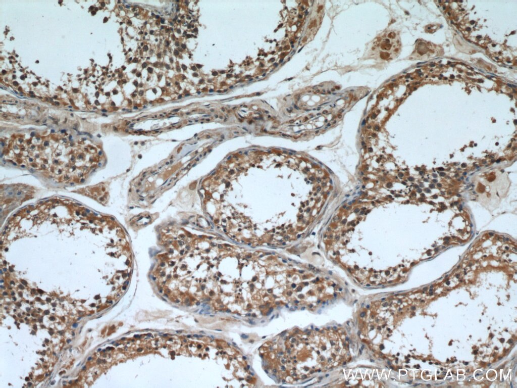 IHC staining of human testis using 12969-1-AP