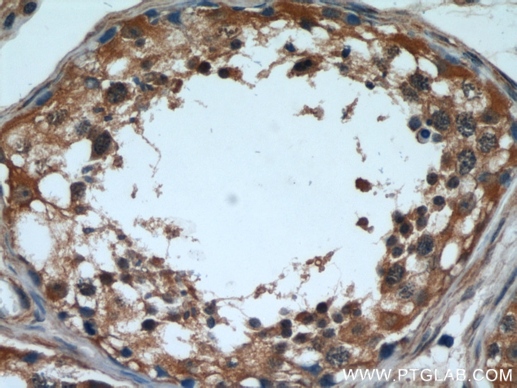 Immunohistochemistry (IHC) staining of human testis tissue using CPT1C-specific Polyclonal antibody (12969-1-AP)