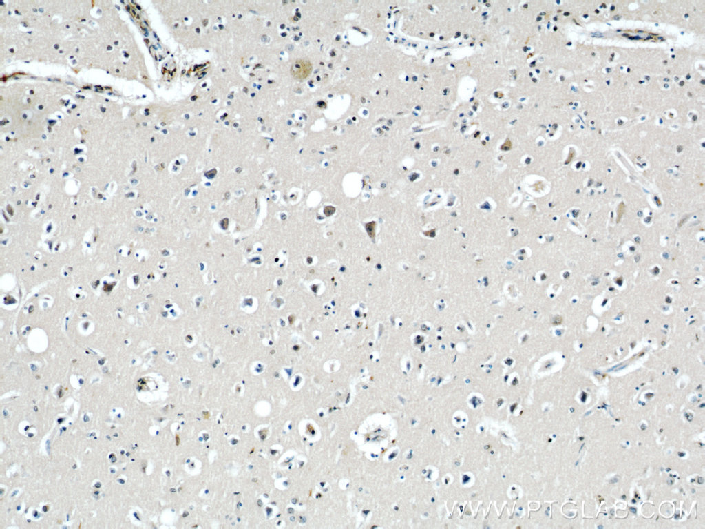 Immunohistochemistry (IHC) staining of human brain tissue using CPT1C-specific Polyclonal antibody (12969-1-AP)