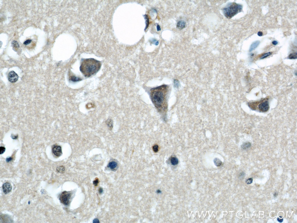 Immunohistochemistry (IHC) staining of human brain tissue using CPT1C-specific Polyclonal antibody (12969-1-AP)