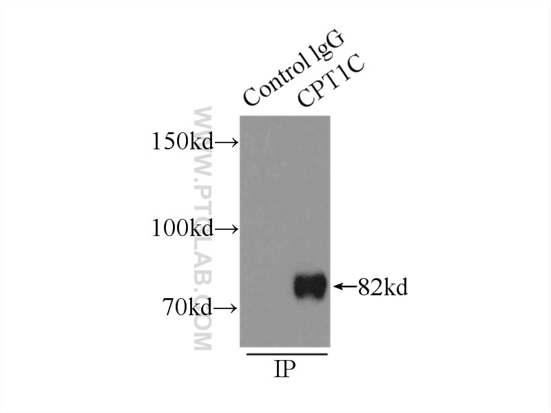 Immunoprecipitation (IP) experiment of mouse testis tissue using CPT1C-specific Polyclonal antibody (12969-1-AP)